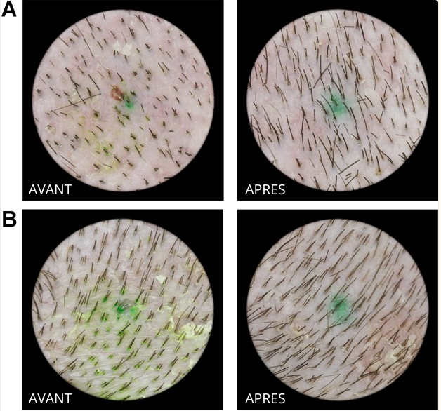 LumiBrush - Brosse de massage pour la pousse des cheveux/barbe