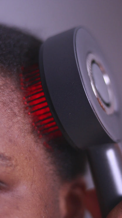 Dermaroller 0,5mm 540 micro aiguilles - Microneedling pour la barbe, les cheveux et le visage